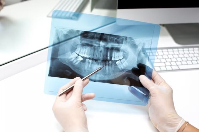 Când este necesară radiografia dentară?